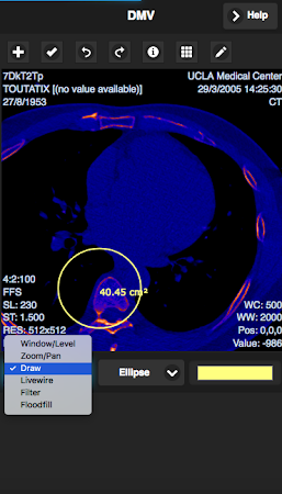 free dicom viewer android