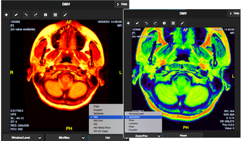 free dicom viewer android